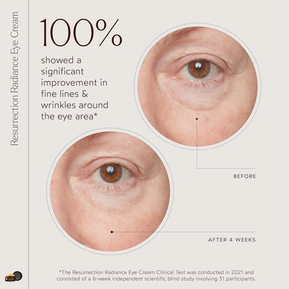 True Botanicals Resurrection Radiance Brightening Eye Cream | Reduces Appearance of Dark Circles, Fine Lines, Wrinkles & Puffiness | Dermatologist Tested, All Natural, Vegan| 0.5 oz | 15 ml