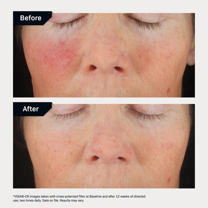 Revision Skincare C+ Correcting Complex 30%® Vitamin C Serum for Face – Anti-Aging Treatment to Brighten Skin, Reduce Fine Lines, Wrinkles & Dark Spots, Firming & Safe for Sensitive Skin