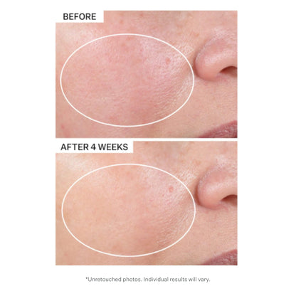 StriVectin Advanced Retinol, Targets Visible Signs of Aging for Healthier Skin