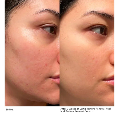 Dr. Dennis Gross Advanced Retinol + Ferulic Texture Renewal Serum – Anti-Aging Formula to Smooth Texture, Boost Radiance, and Minimize Fine Lines & Wrinkles, 1 oz