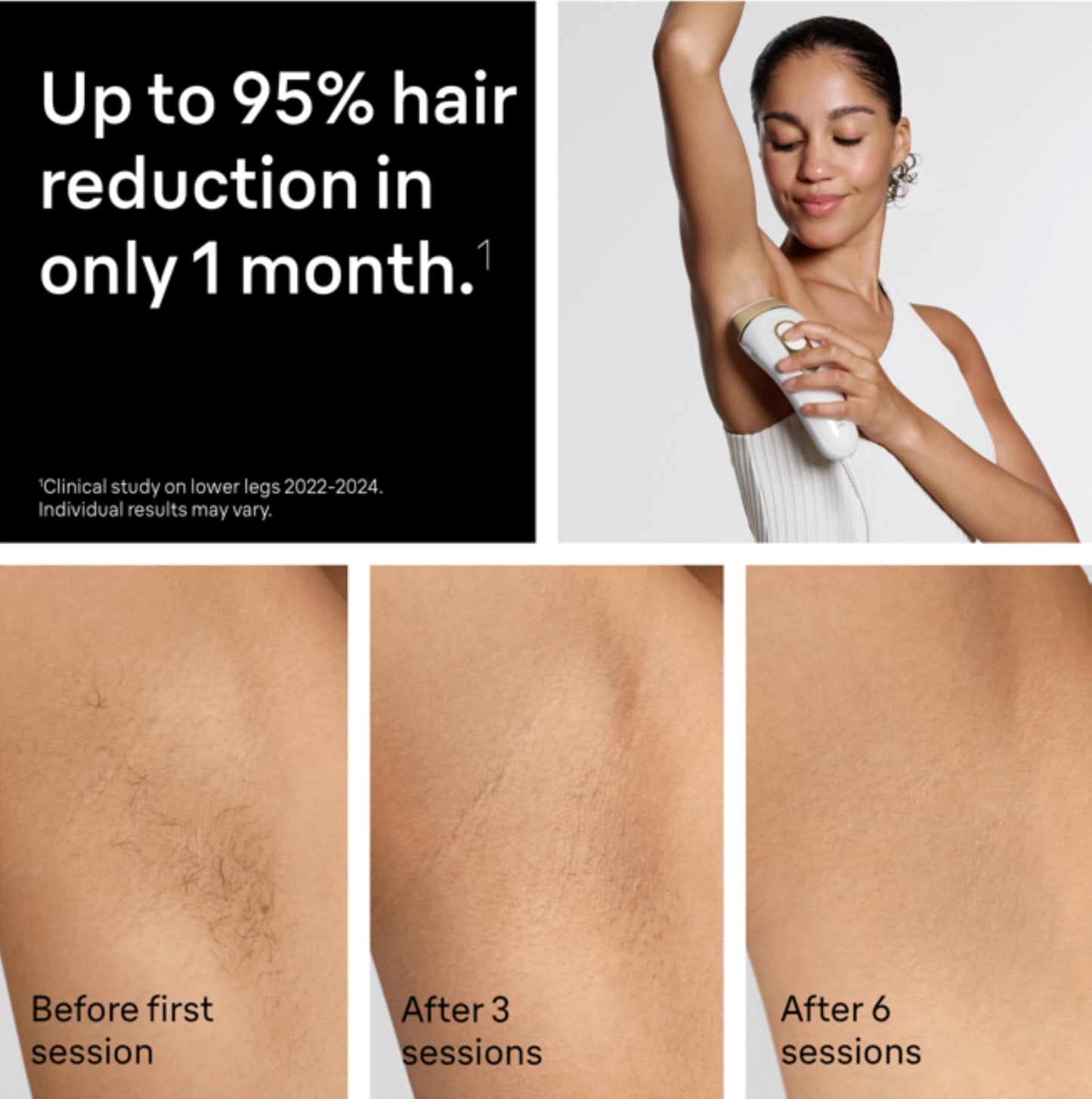 Braun IPL, Silk·Expert Pro 5, IPL Hair Removal for Women and Men, Permanent Laser Hair Reduction At-Home, 2 Heads, Pouch, Venus Razor, IPL5157