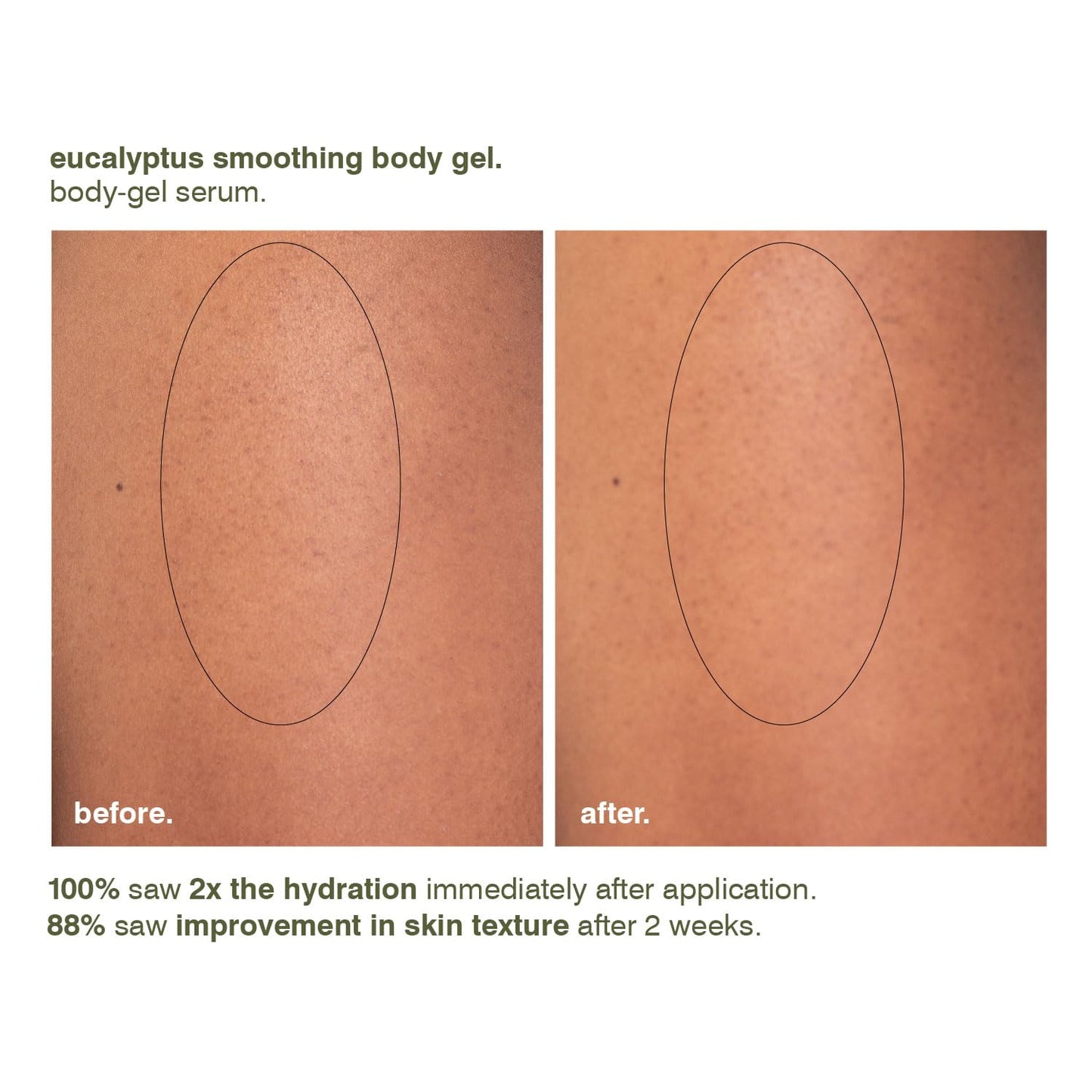 MALIN+GOETZ Eucalyptus Smoothing Body Gel | Restorative Gel-to-Water Serum with Magnesium PCA, Urea + Phytic Acid | Improves Texture, Smoothness + Barrier Function | Vegan + Cruelty-Free (7.5 Fl Oz.)