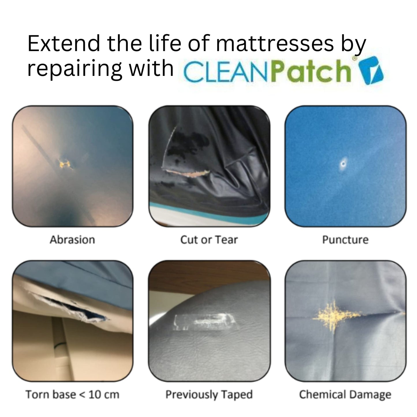 Diversey 11003 CLEANPatch Medical Surface Repair Patch for Hospital Beds & Stretchers, 2-Inch Round Patch (10 Patches), 1-Box