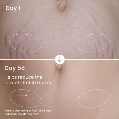 MAËLYS B-FLAT Belly Firming Cream for Women - Skin Tightening & Moisturizing Treatment with Shea Butter & Bentonite Clay - Smooths Look of Stretch Marks - Postpartum Body Care (3.4 Fl Oz)