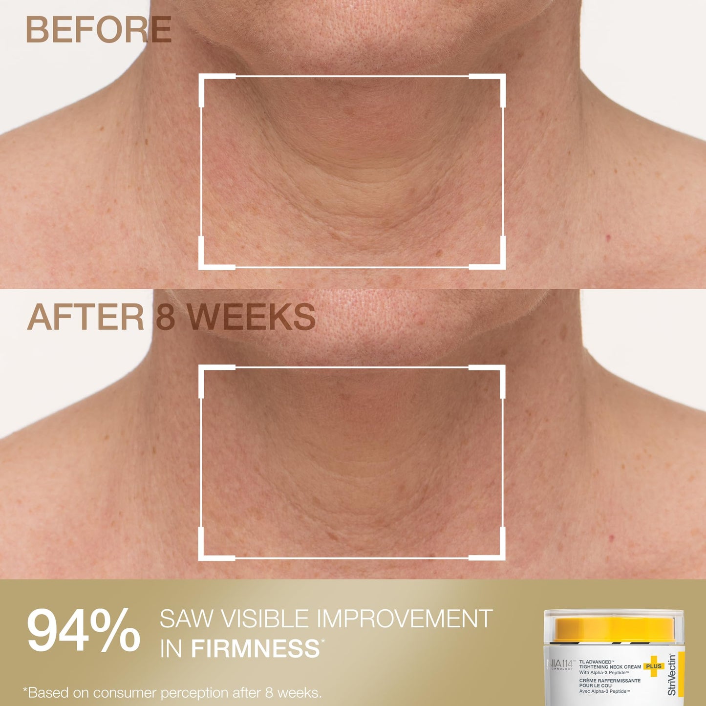 StriVectin Tighten & Smooth Neck Cream and Neck Serum Roller Anti-aging Skin Care 2-Piece Set, Smoothing Look of Wrinkles and Fine Lines, Improves Crepey Skin and Vertical Lines
