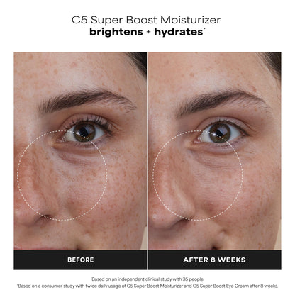 Paula's Choice C5 Super Boost Face Moisturizer with 5% Vitamin C & Squalane, Daily Face Lotion for Discoloration, Uneven Tone, Fine Lines & Breakout-Prone Skin, Fragrance-Free