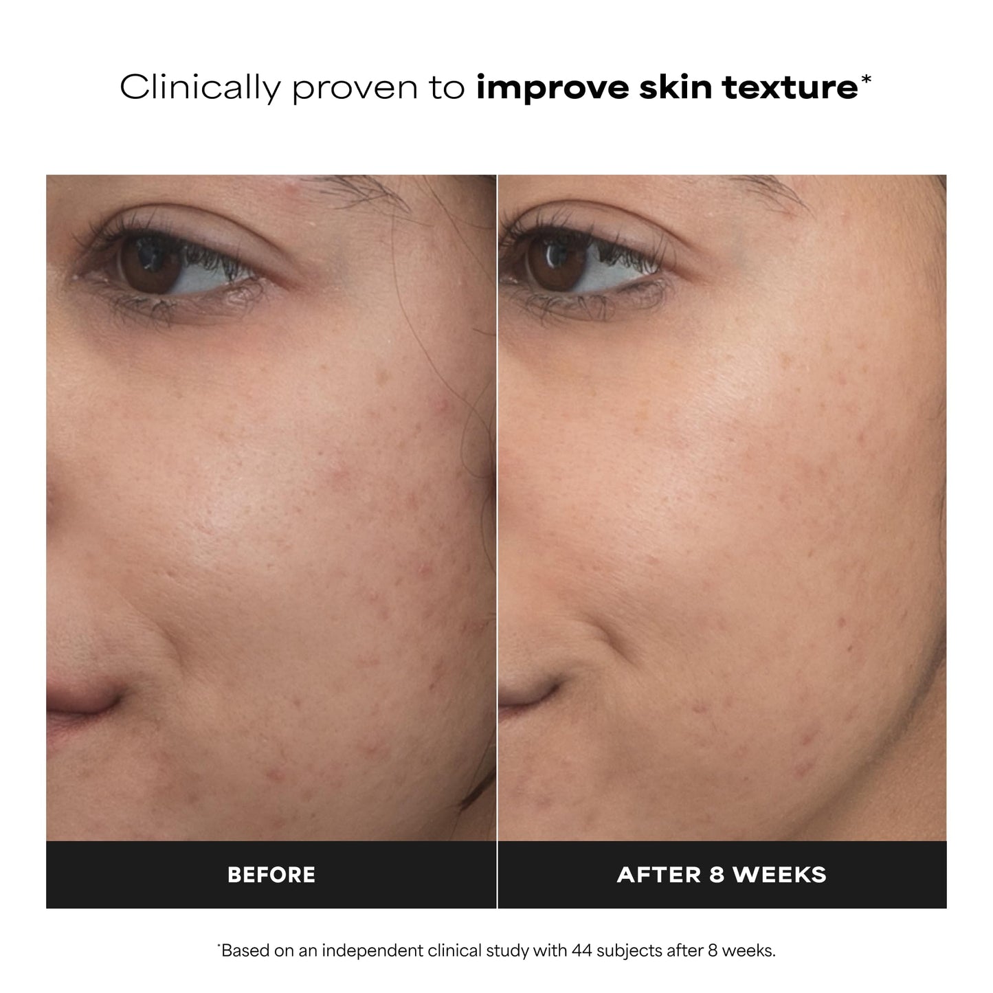 Paula’s Choice Pro Retinaldehyde Dual-Retinoid Face Serum Advanced Treatment, High Potency Anti-Aging Serum for Face, Breakout-Prone Skin, Radiance & Rough, Bumpy Texture, Fragrance-Free