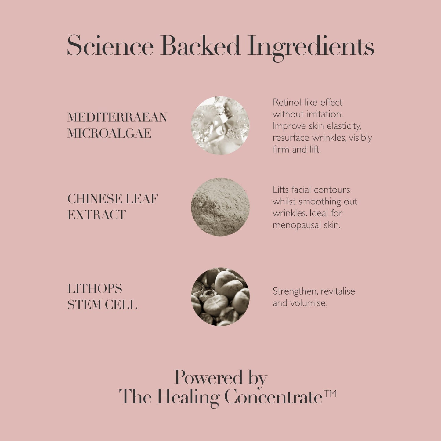 Omorovicza Queen Serum (1.0 oz), Retinoid Facial Serum with Mediterranean Microalgae, Lithops Stem Cells & Chinese Leaf Extract to Reduce Wrinkles, Firm & Smooth Skin