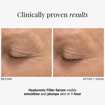 G.M. COLLIN Hyaluronic Filler Serum | Hydrating Hyaluronic Acid for Face | Anti-Aging Formula for Visibly Reducing Wrinkles