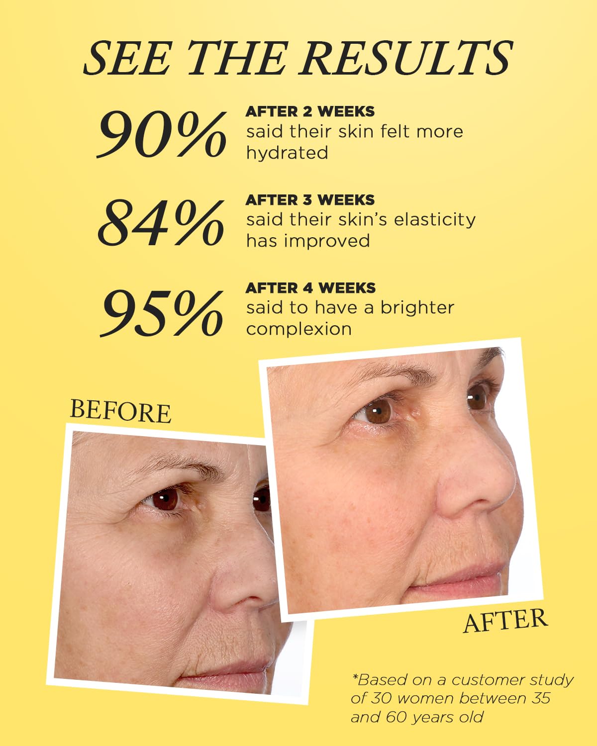 10% Vitamin C Serum for Face – FRÉ Waterless Brightening Serum with Argan Oil – 1.01 fl oz
