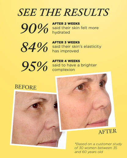 10% Vitamin C Serum for Face – FRÉ Waterless Brightening Serum with Argan Oil – 1.01 fl oz