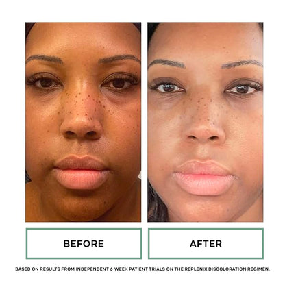 Replenix Vitamin C Pro Collagen Serum, Brightening Anti-Aging Face Treatment with Medical-Grade Antioxidants for Skin Discoloration