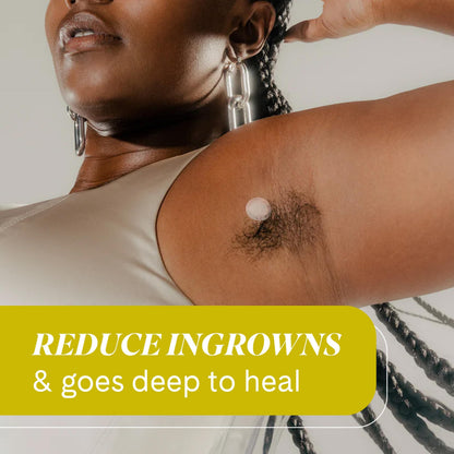 Fur Ingrown Microdart Patches - Ingrown Hair Care, Quickly and Effectively Clear Up Ingrown Hair Bumps - 12 Pack