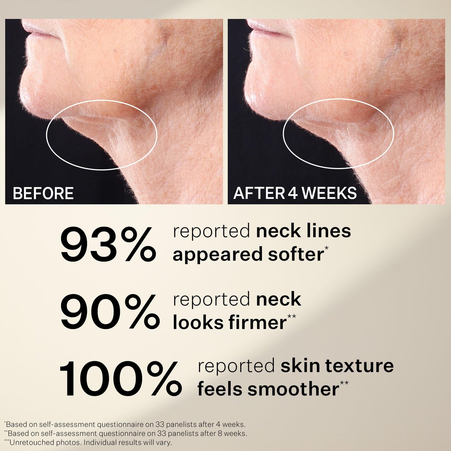 StriVectin Tighten & Lift Peptight™ Tightening Neck Anti-Aging Serum Roller, 1.7 fl. oz.