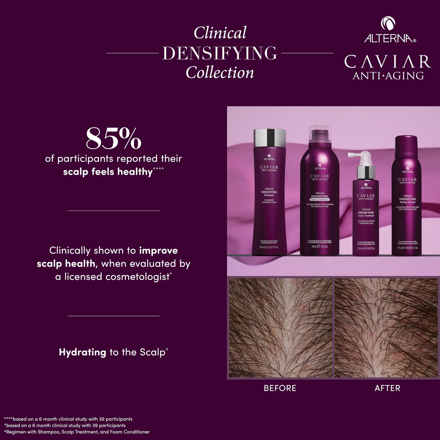 CAVIAR Anti-Aging Clinical Densifying Shampoo | For Fine, Thinning Hair | Thickens Hair, Protects Scalp | Sulfate Free