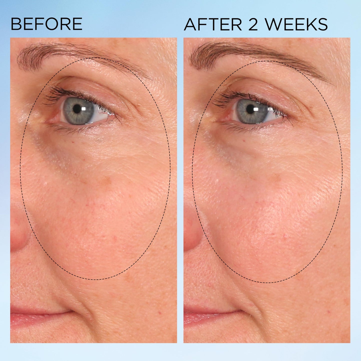 Elizabeth Arden Visible Brightening Clearly Radiant Dark Spot Corrector & Vitamin C Serum Capsules, Corrects Post-Acne Scars, Reduces Pores & Evens Skin Tone