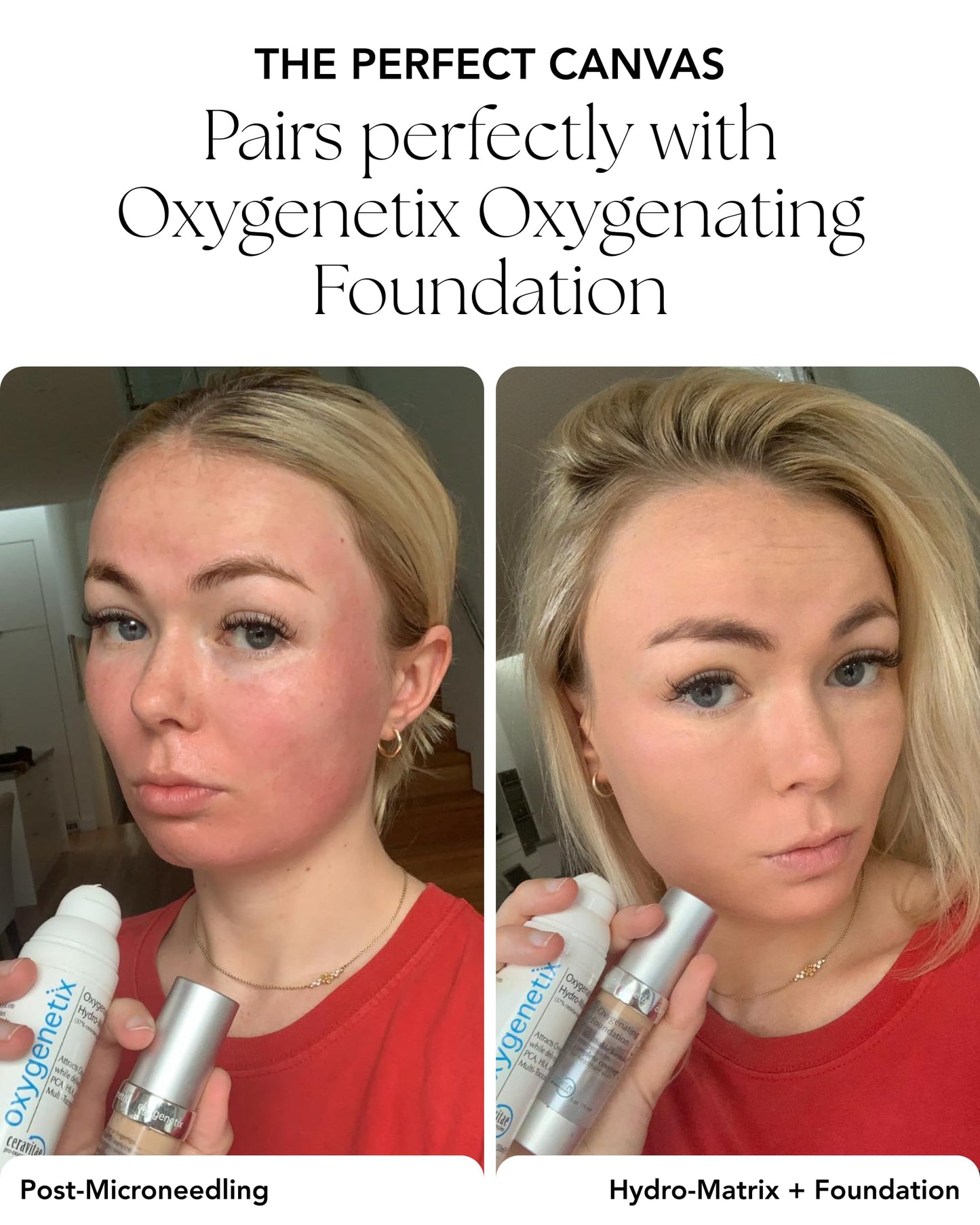 Oxygenetix Oxygenating Hydro-Matrix (1oz) | Lightweight Aloe-Based Face Moisturizer with Hyaluronic Acid for Sensitive, Dry, or Compromised Skin
