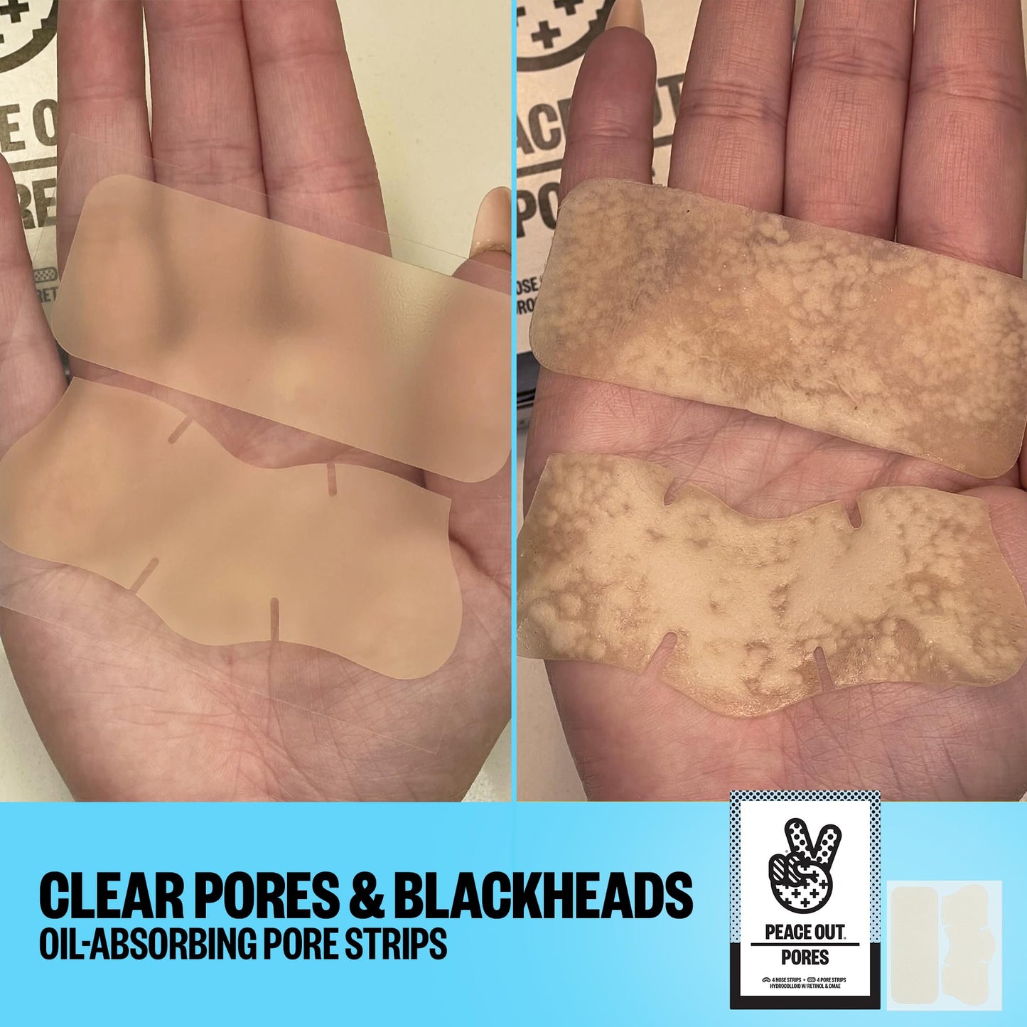 PEACE OUT Pore Strips for Nose and Face, Oil Absorbing Hydrocolloid Blackhead Remover, Pore Minimizing Strips with Retinol, Multi-Use Face Strips for Clogged Pores, 8 Count