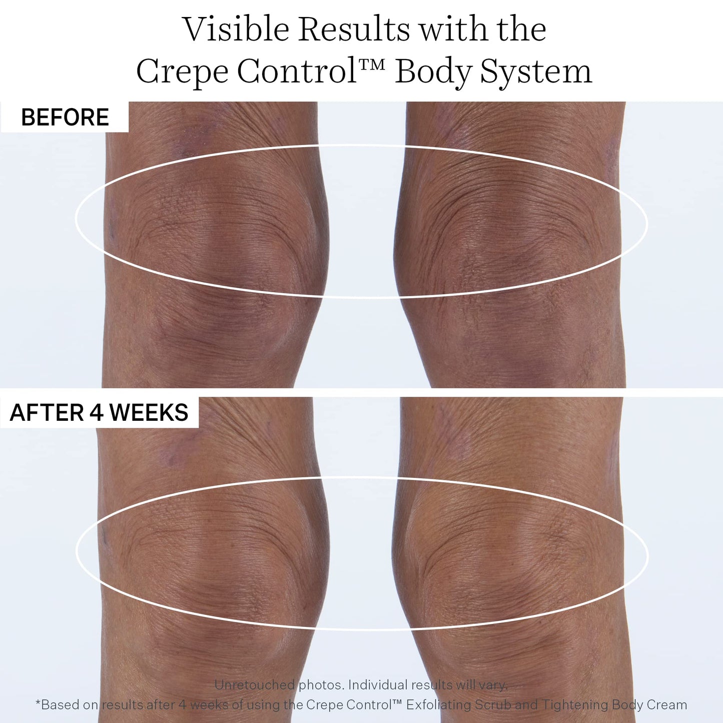 StriVectin Crepe Control Tightening Body Cream Jumbo