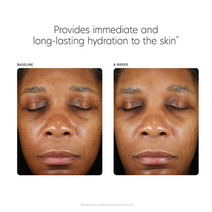 PCA SKIN Hyaluronic Acid Boosting Face Serum, Hyaluronic Acid Serum for Face Made with Niacinamide and Ceramides, Helps Reduce Fine Lines and Wrinkles and Delivers 24-Hour Moisturization, 1 oz Pump