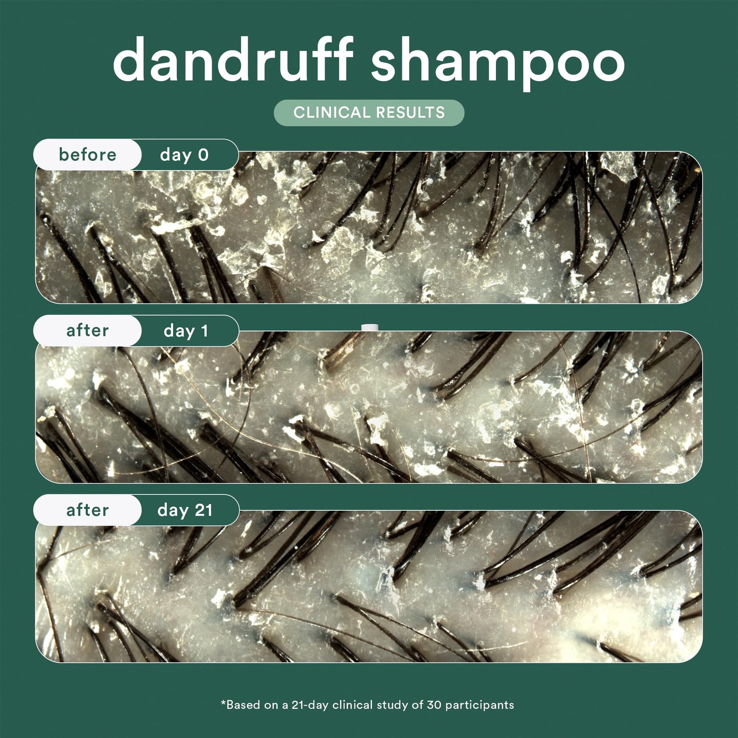 VERB® Dandruff Shampoo - for Gentle Cleansing and Clinical Strength Dandruff Relief with 3% Salicylic Acid