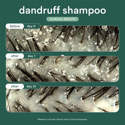 VERB® Dandruff Shampoo - for Gentle Cleansing and Clinical Strength Dandruff Relief with 3% Salicylic Acid