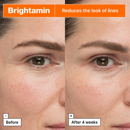Dr.Jart+ Brightamin Brightening Korean Vitamin C and Niacinamide Serum For Visible Fine Lines | Dark Spot Correcting Glow Serum | Korean Skin Care, 0.27 Fl Oz