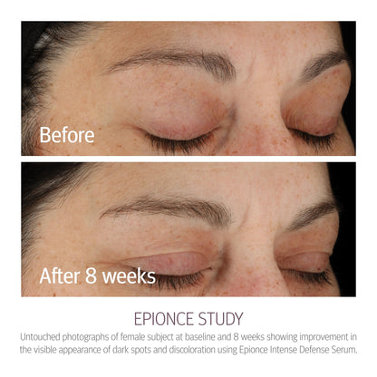 Epionce Intense Defense Serum - Anti-Aging Facial Serum with Vitamin C, Vitamin E, Vitamin D, A, B, & Niacinamide, Dermatologist Skincare