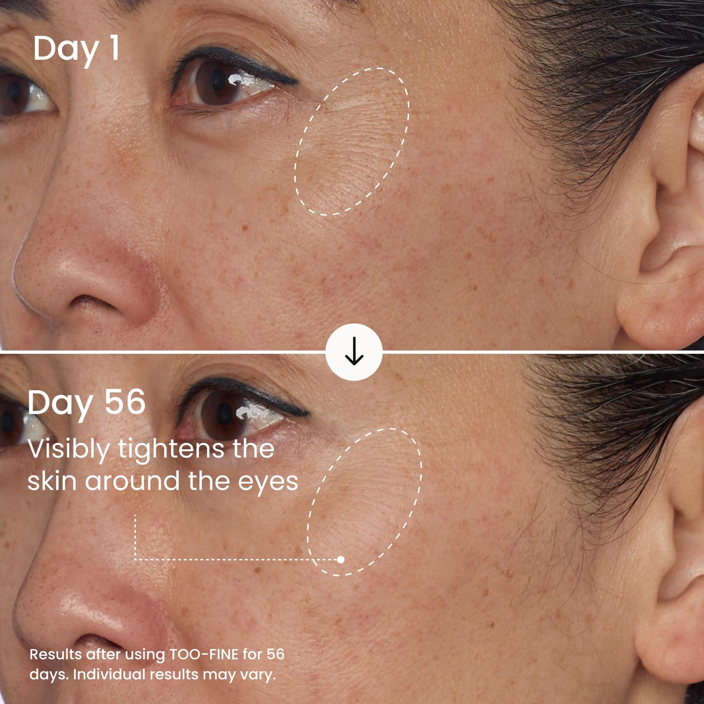 MAËLYS TOO-FINE Face Serum for Women - Firming Anti-Aging Serum with Glaucine & Bacillus Ferment - Helps Lift the Look of Sagging Skin on Jawline, Cheekbones & Under Eyes (15 mL)