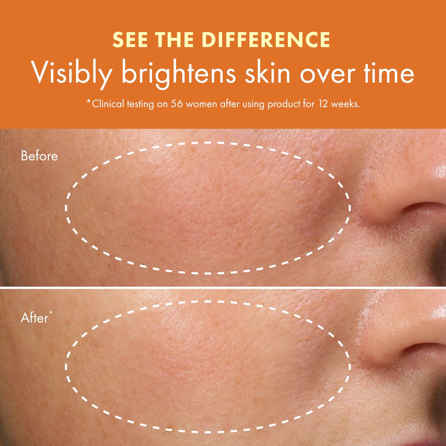 Origins GinZing Energizing Gel Cream | Face Moisturizer for Radiance and Glow | With Vitamin C, Niacinamide, Ginseng, and Caffeine
