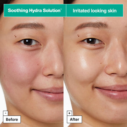 Dr.Jart+ Dermask Soothing Hydra Solution Korean Face Mask for Visibly Irritated Skin | Sheet Mask | Korean Skin Care