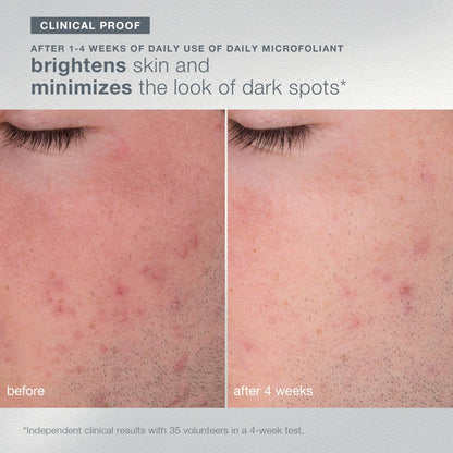 Dermalogica Your Moment of Expertise – Expert Level Skin Care Routine Set Includes 6 Products, Headband, Gua Sha, Fan Brush