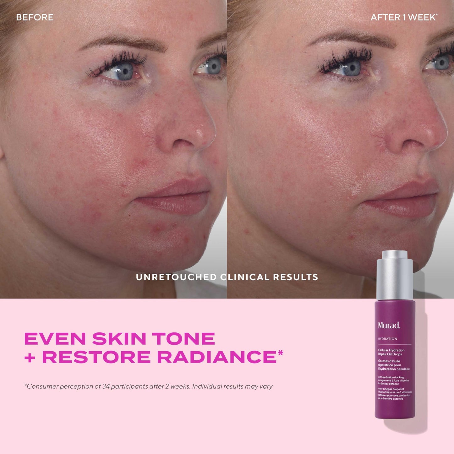 Murad Cellular Hydration Repair Oil Drops – Hydrating Facial Oil for Dry, Dehydrated Skin – Strengthens Skin Barrier, Boosts Radiance & Smoothness – Lightweight, Fast-Absorbing Formula – 1.0 oz