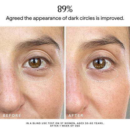 HERBIVORE Super Nova Eye Cream – 5% THD Vitamin C & Caffeine, Reduces Dark Circles & Puffiness, Brightens Eyes, Plant-based, Vegan, Cruelty-free, 15mL / 0.5 oz