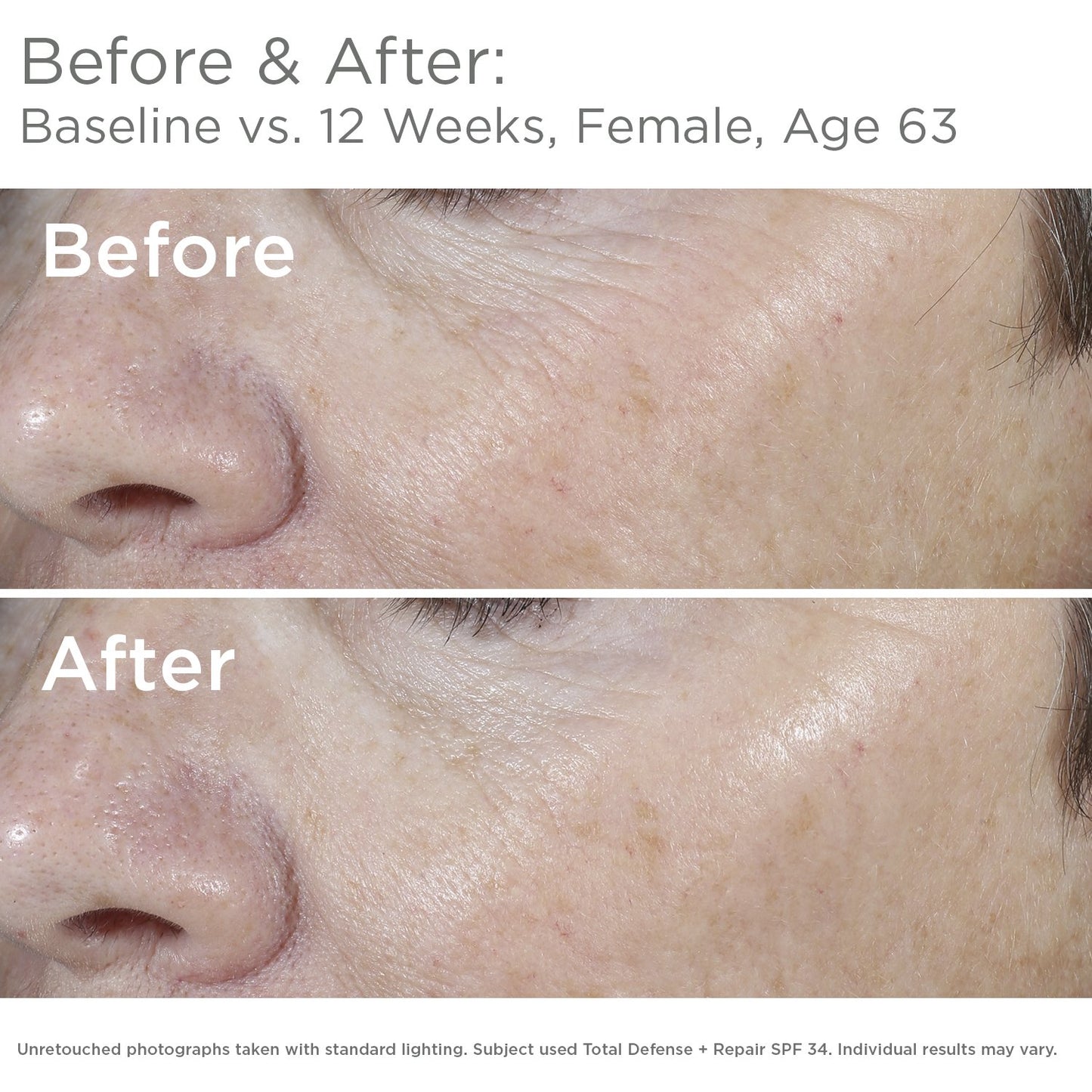 SkinMedica Total Defense + Repair SPF 34 Sunscreen for Face