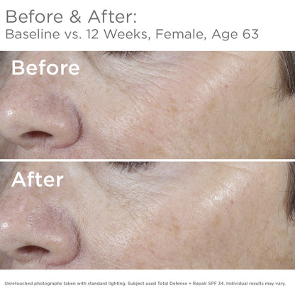 SkinMedica Total Defense + Repair SPF 34 Sunscreen for Face