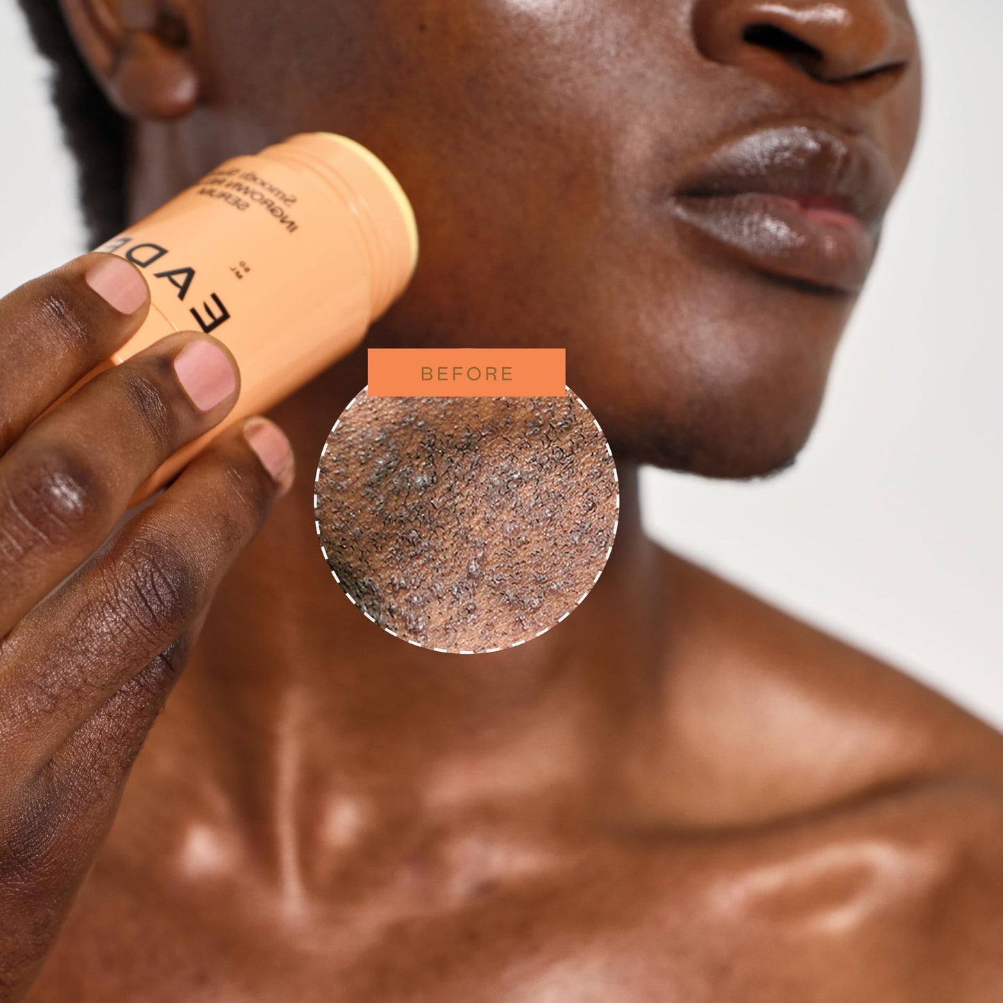 EADEM Smooth Slate Ingrown Hair Roller Serum, Targets Bumps Trapped Hairs, Faded Topicals for Scarring and Dark Spots, AHAs and Tyrosinase, Slows Ingrown Hair Regrowth