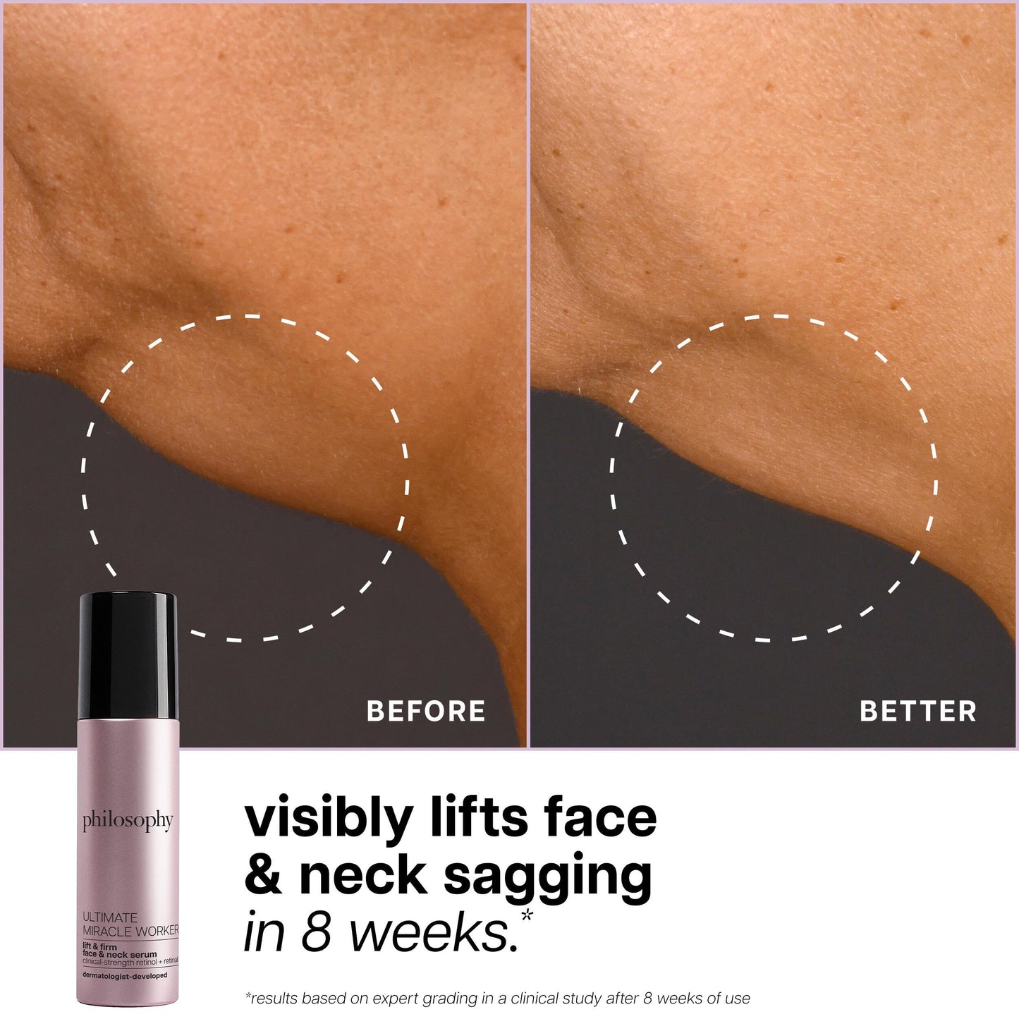 philosophy ultimate miracle worker lift & firm face & neck serum – with encapsulated retinol & retinal ­– anti-aging serum ­– peptide complex – for all skin types