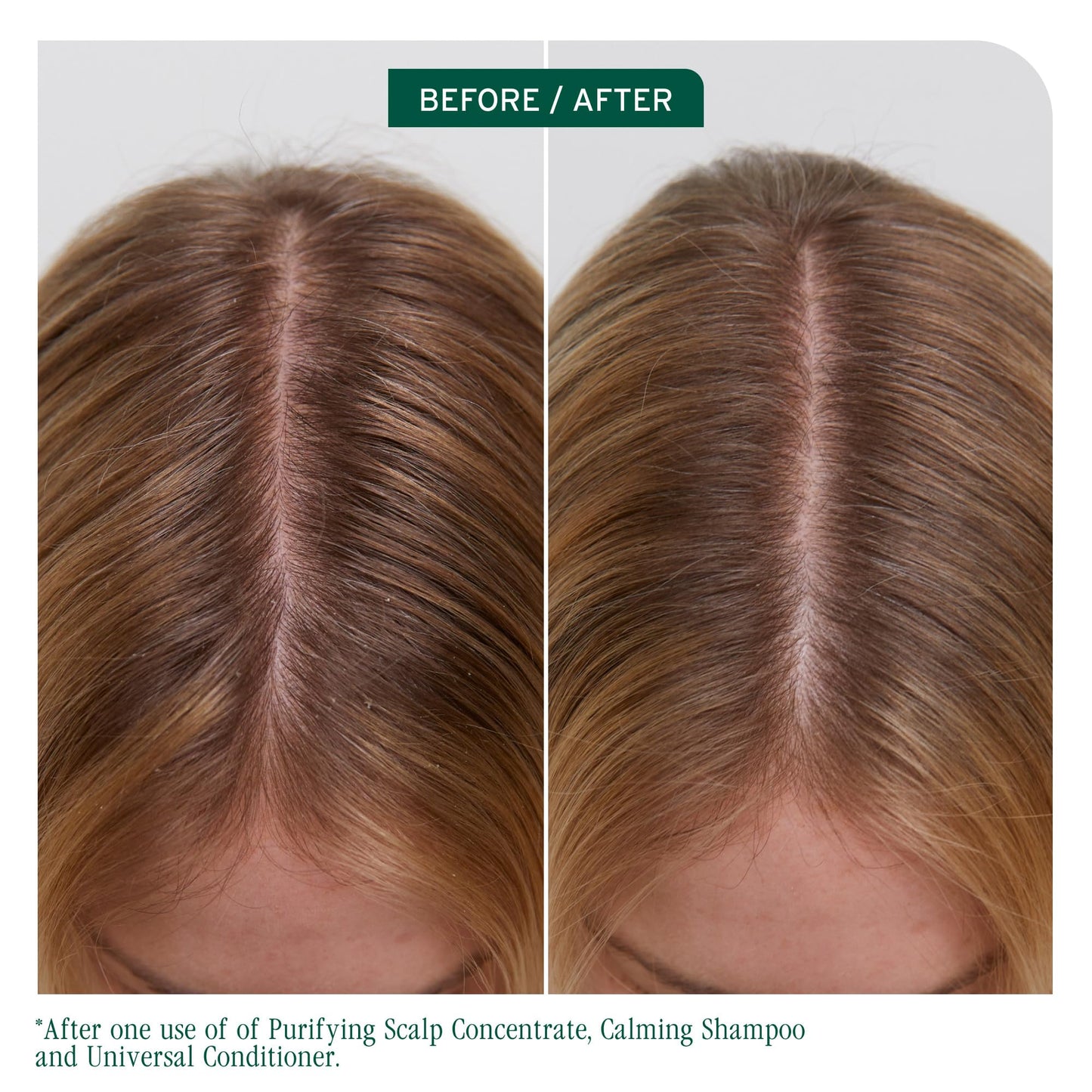 Biolage Scalp Sync Universal Conditioner - Nourishing & Hydrating for All Scalp Types, Lightweight Moisturizing & Conditioning, Fermented Tea Blend & Glycolic Acid, Vegan & Paraben-Free