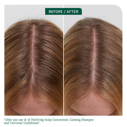 Biolage Scalp Sync Universal Conditioner - Nourishing & Hydrating for All Scalp Types, Lightweight Moisturizing & Conditioning, Fermented Tea Blend & Glycolic Acid, Vegan & Paraben-Free