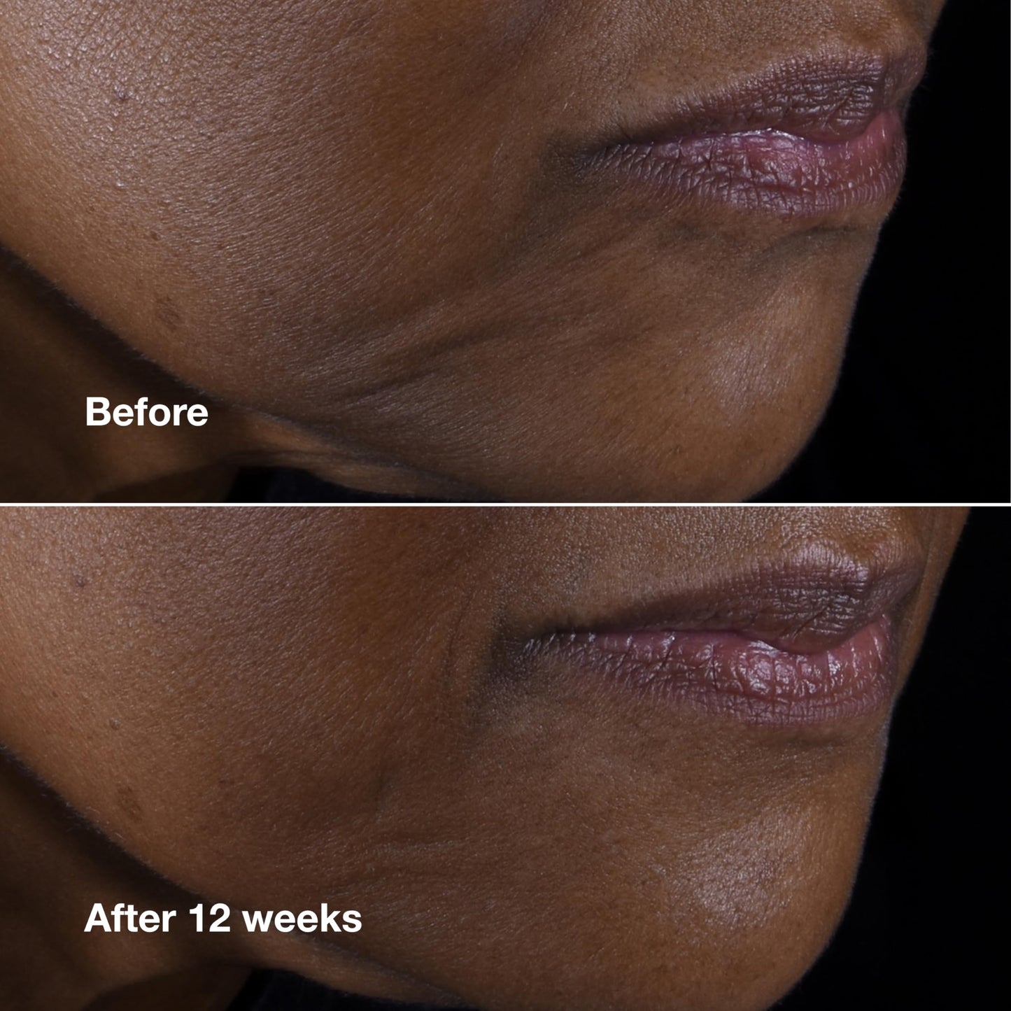 Clinique Smart Clinical Repair Anti Aging Lifting Face + Neck Cream with Peptides + Hyaluronic Acid For All Skin Types | Hydrating