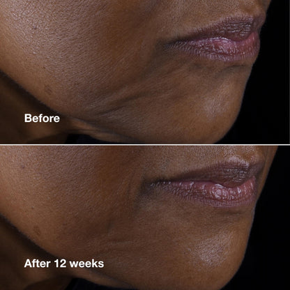 Clinique Smart Clinical Repair Anti Aging Lifting Face + Neck Cream with Peptides + Hyaluronic Acid For All Skin Types | Hydrating