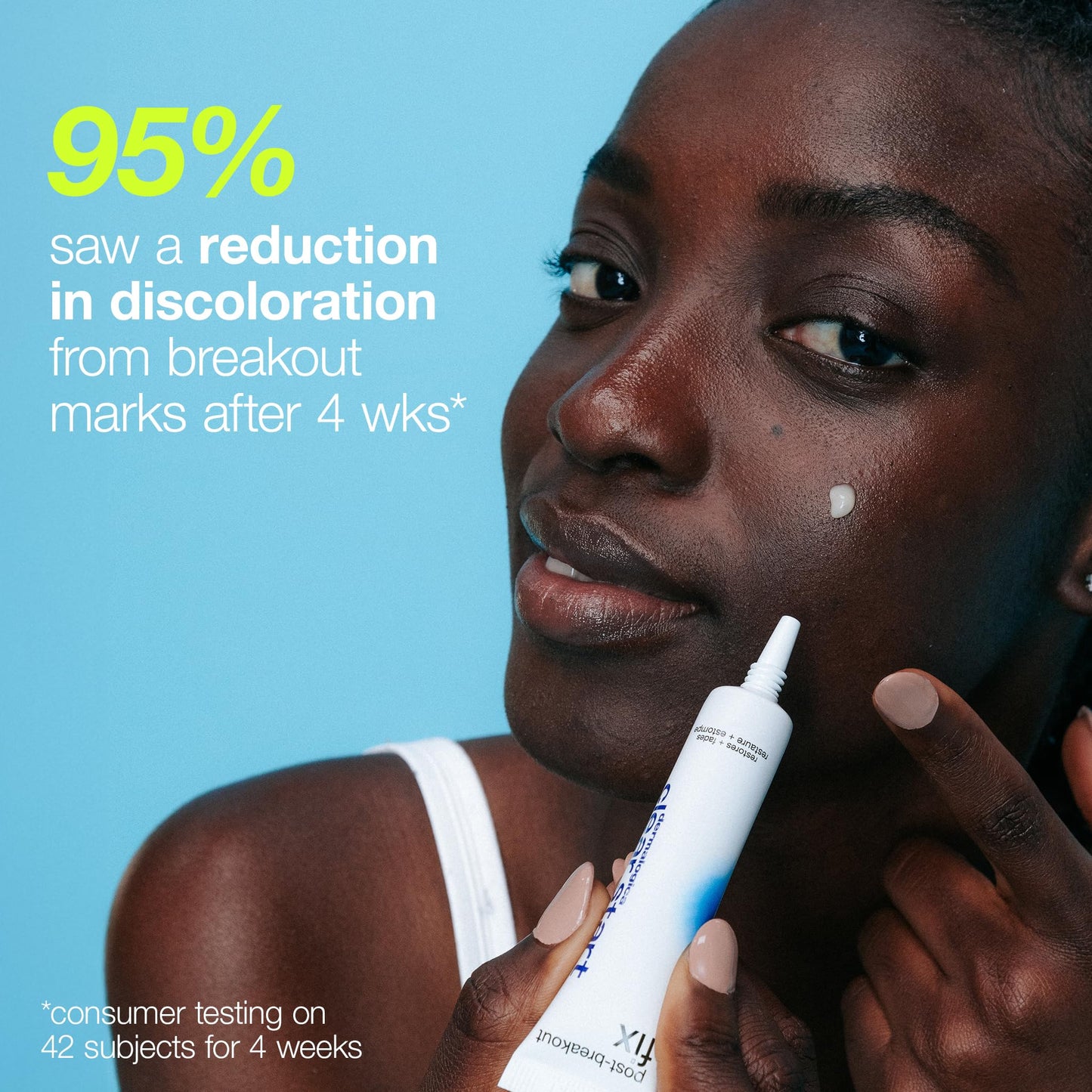 Dermalogica Clear Start Post-Breakout Fix, Acne Dark Spot Treatment with Salicylic Acid, Squalene & Hexylresorcinol, Fade + Brighten Acne Marks