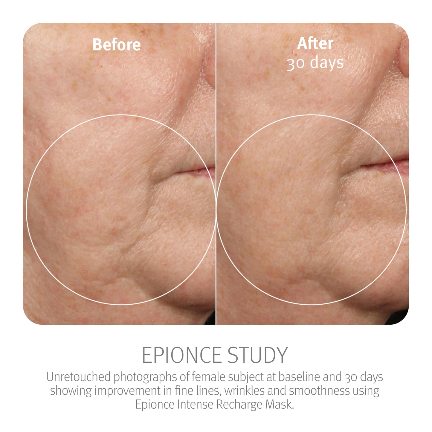 Epionce Intense Recharge Mask - Anti-Aging Clay Face Mask for All Skin Types, Hydrating Mask with Kaolin for the Skin Barrier, Dermatologist Skincare