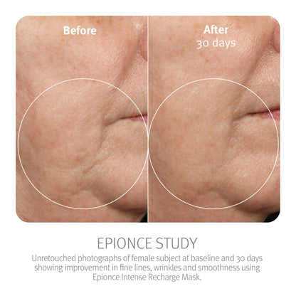 Epionce Intense Recharge Mask - Anti-Aging Clay Face Mask for All Skin Types, Hydrating Mask with Kaolin for the Skin Barrier, Dermatologist Skincare