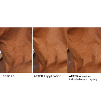 NassifMD Age Defying Neck & Décolleté Serum, Lifts and Firms Thin Neck Skin, Hydrates and Smooths