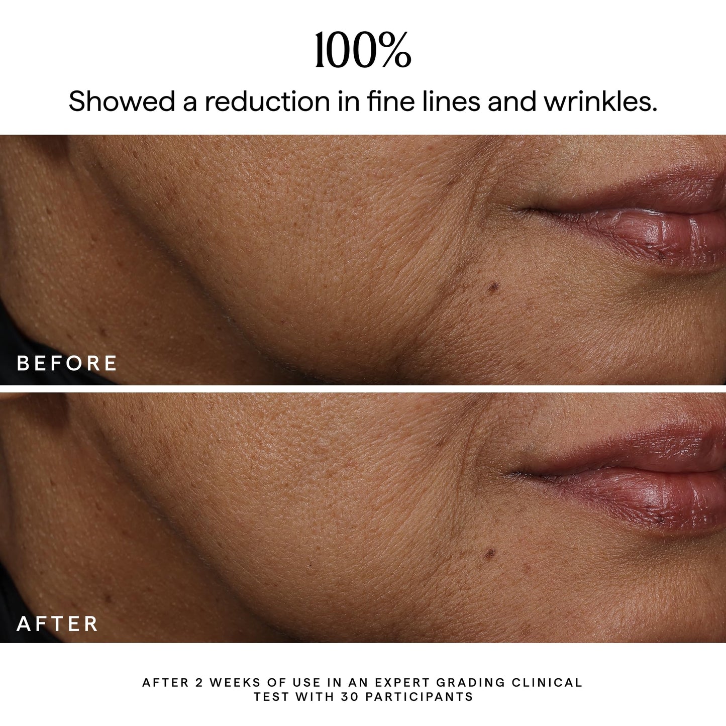HERBIVORE Bakuchiol Retinol Alternative Face Serum | Smooths Skin, Improves Texture & Elasticity, Reduces Fine Lines & Wrinkles | Plant-based, Vegan, Cruelty-free, 30mL / 1 oz