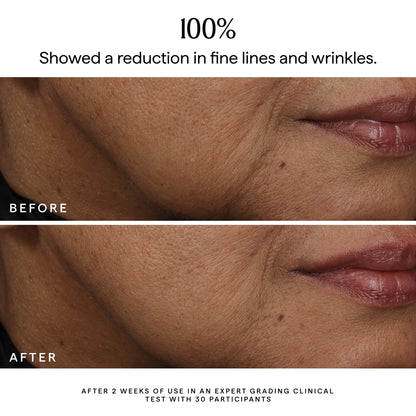 HERBIVORE Bakuchiol Retinol Alternative Face Serum | Smooths Skin, Improves Texture & Elasticity, Reduces Fine Lines & Wrinkles | Plant-based, Vegan, Cruelty-free, 30mL / 1 oz