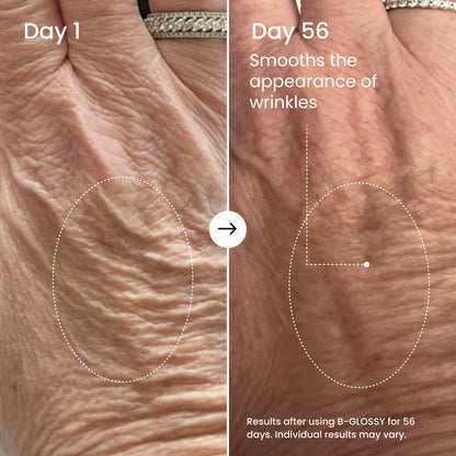 MAËLYS B-GLOSSY Smoothing Body Serum for Women - Hyaluronic Acid & Peptide Formula - Helps Reduce the Look of Wrinkles, Texture & Crepey Skin - Lightweight, Fast-Absorbing Anti-Aging Serum (3.4 Fl Oz)