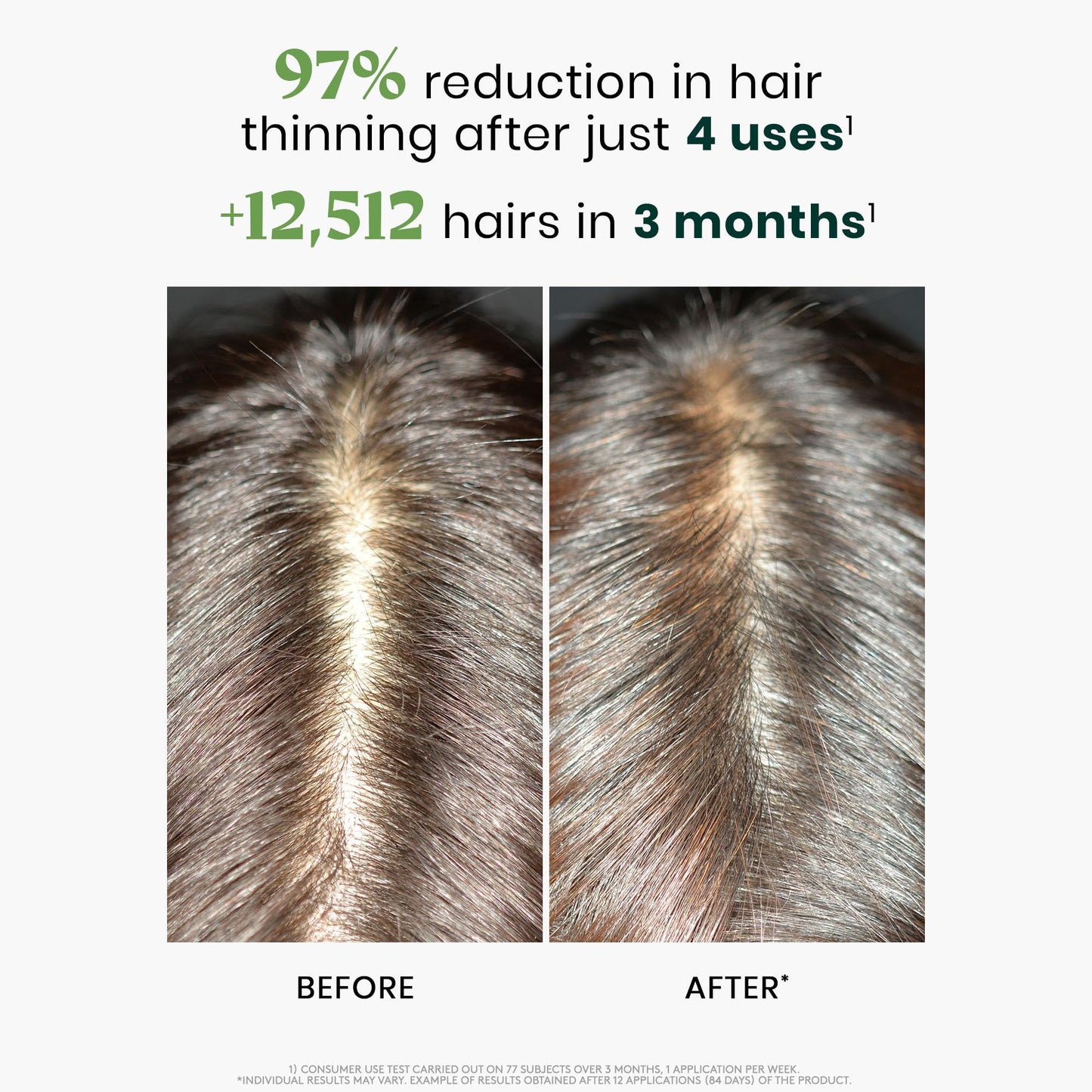 Rene Furterer Triphasic Reactional Concentrated Serum - Thinning Hair caused by stress, postpartum, seasonal change - Drug-Free - Breastfeeding Safe - Dermatologist tested - 12 ct., 3-Month Supply